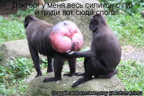 Доктор! у меня весь силикон с губ и груди вот сюда сполз!... Котоматрица: Доктор! у меня весь силикон с губ и груди вот сюда сполз!