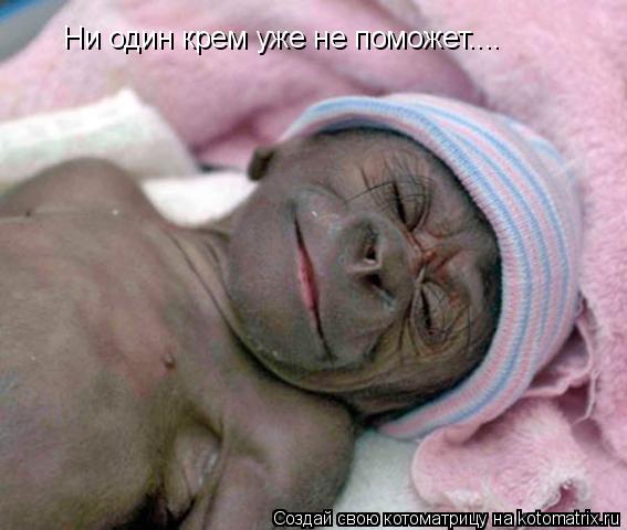 Котоматрица: Ни один крем уже не поможет....